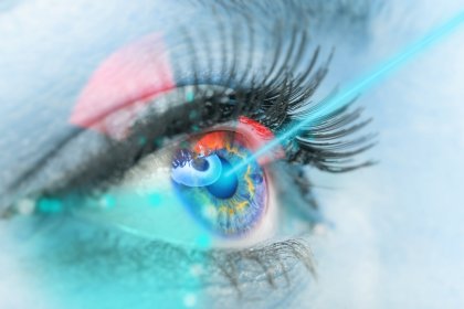 cataract surgery