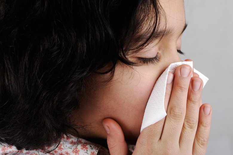 How to deal with allergies?