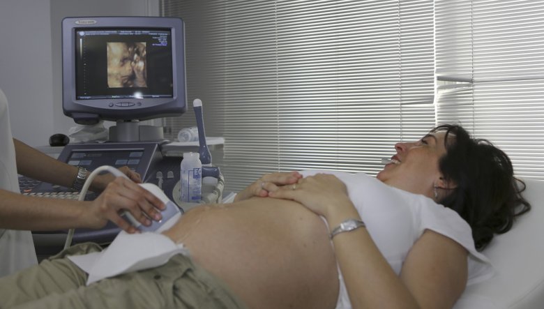 ultrasonography